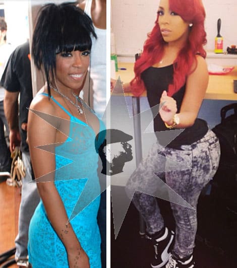 K. Michelle Before & After Butt Implants