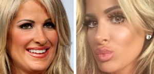 kim zolciak before and after