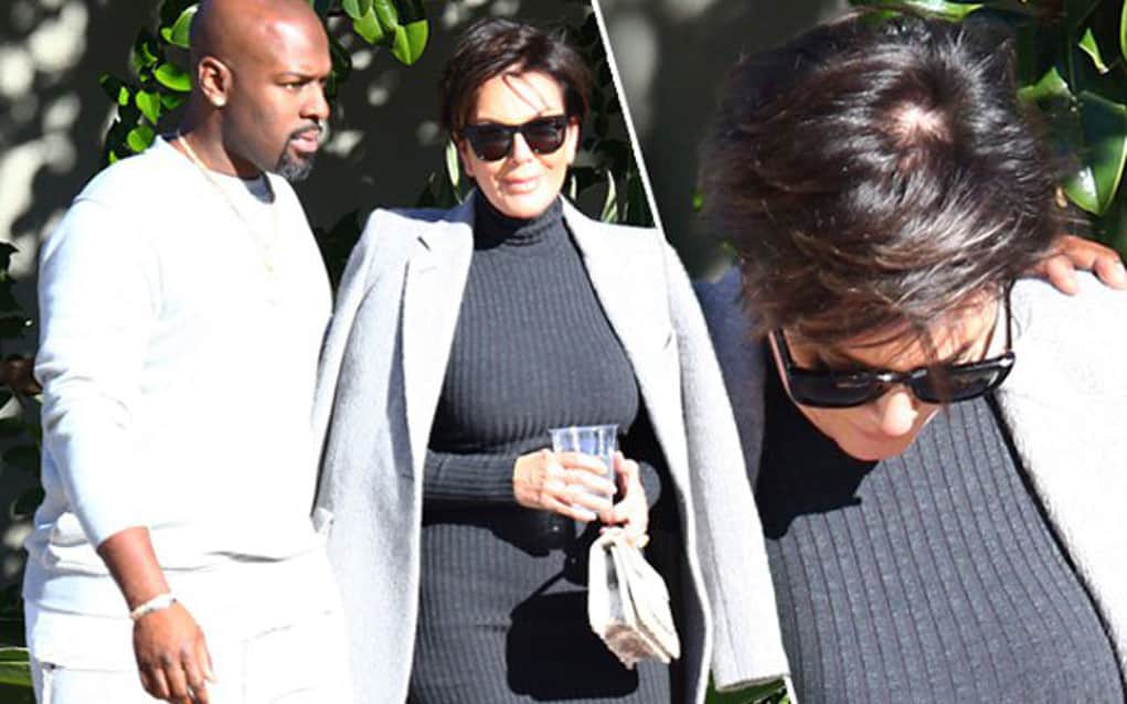 kris jenner bald 2