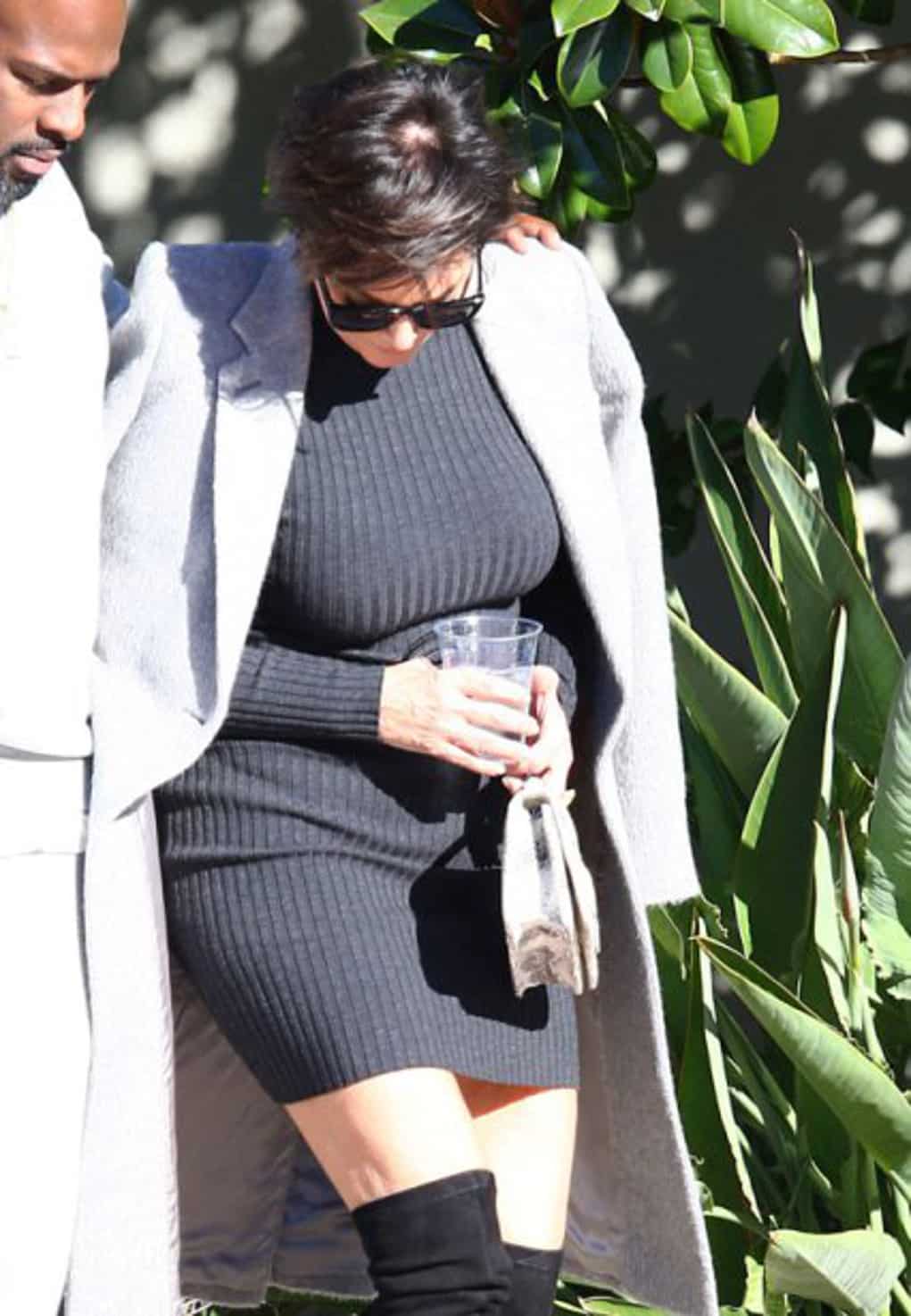 kris jenner bald 3