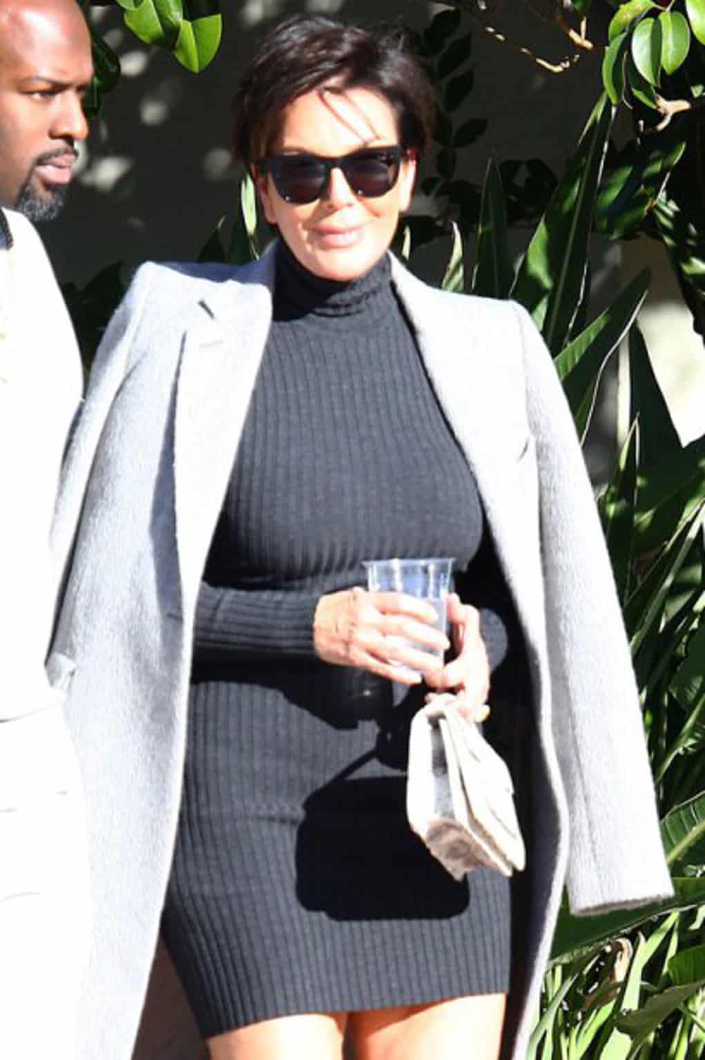 kris jenner bald 5