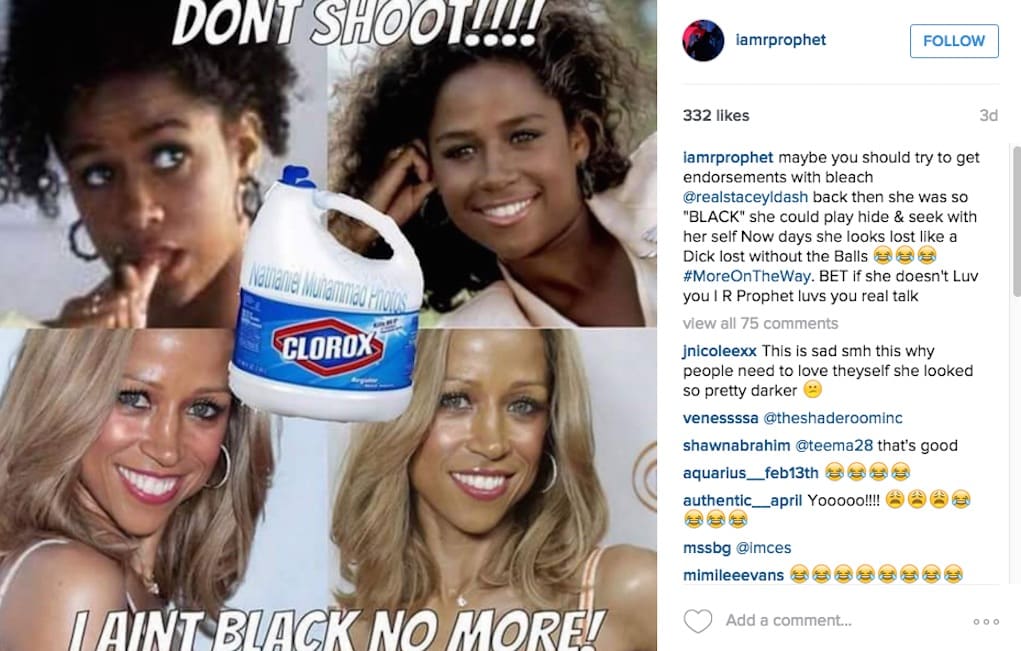 stacey dash skin bleach