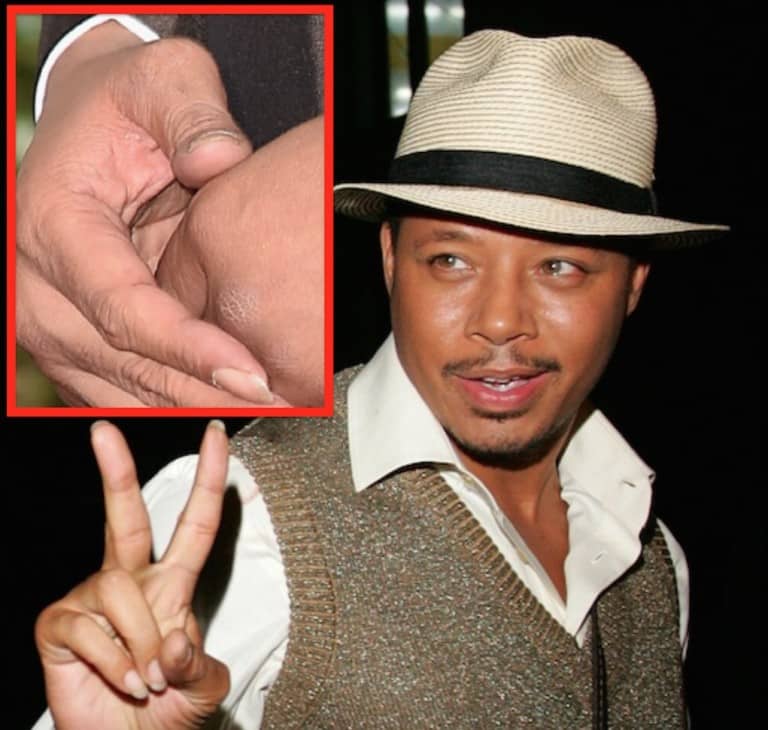 Terrence Howard’s Got A Hand Full Of Herpes!