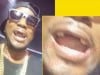 jeezy teeth fall out