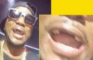 jeezy teeth fall out