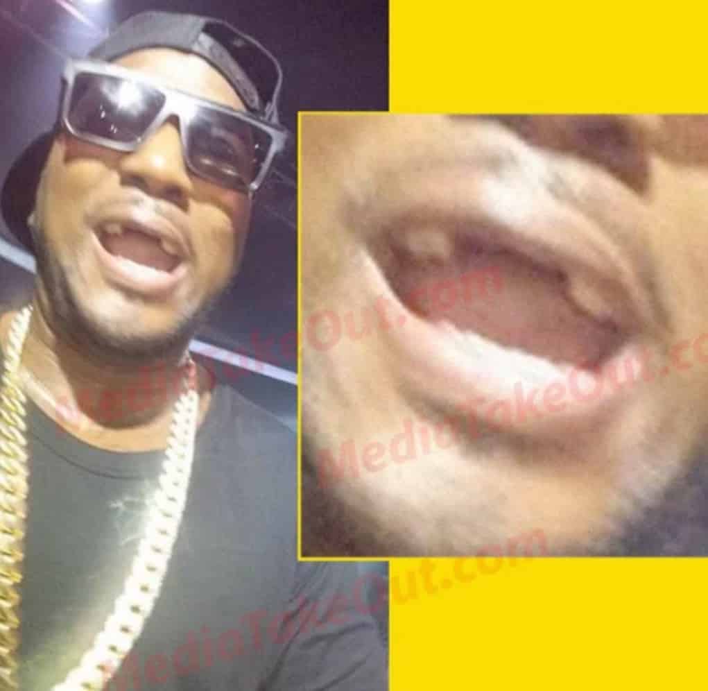 jeezy teeth fall out