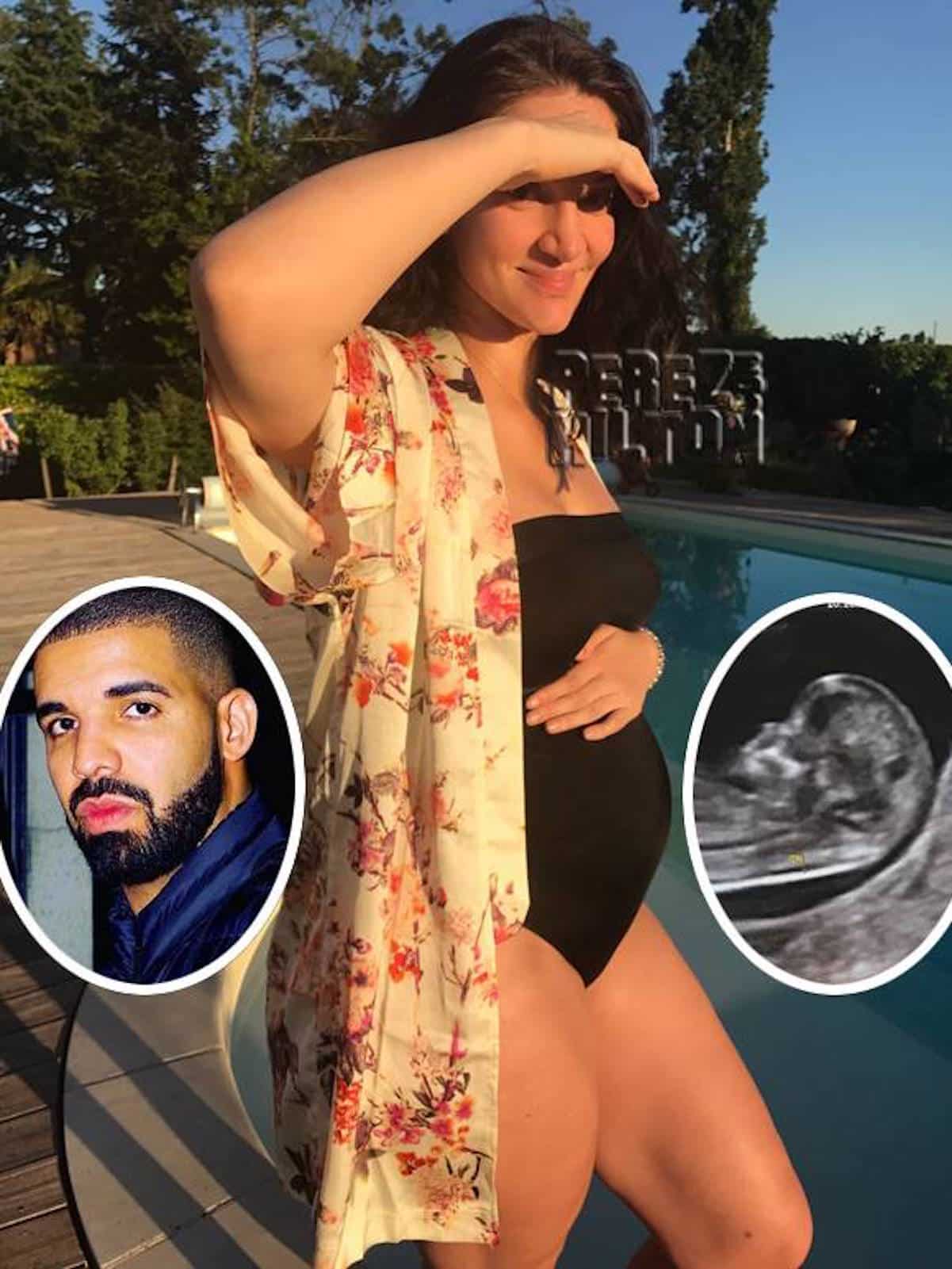 drake baby mama sonogram