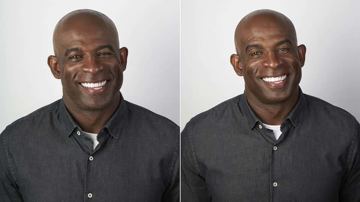 deion sanders botox