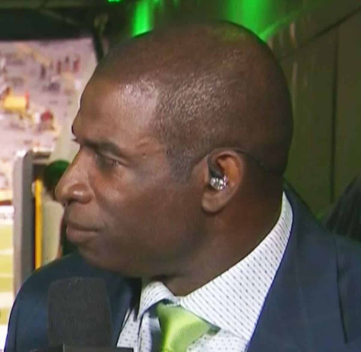 deion sanders hair plugs