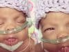 alexis skyy cps